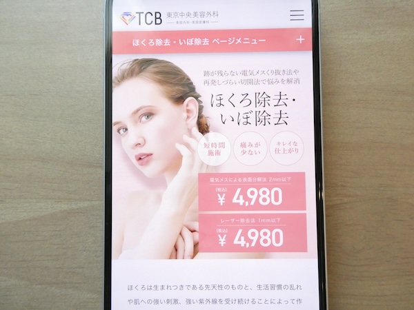 TCB東京中央美容外科は電気メスが手頃で相談しやすい【大宮（埼玉）おすすめ1】