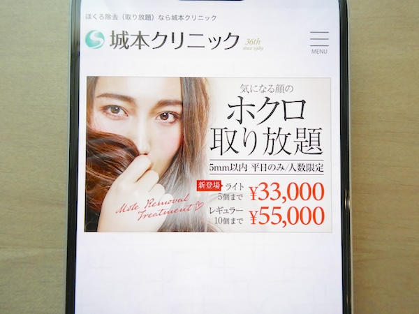 城本クリニックはほくろ取り放題で最大10個まで相談プランあり【千葉おすすめ4】