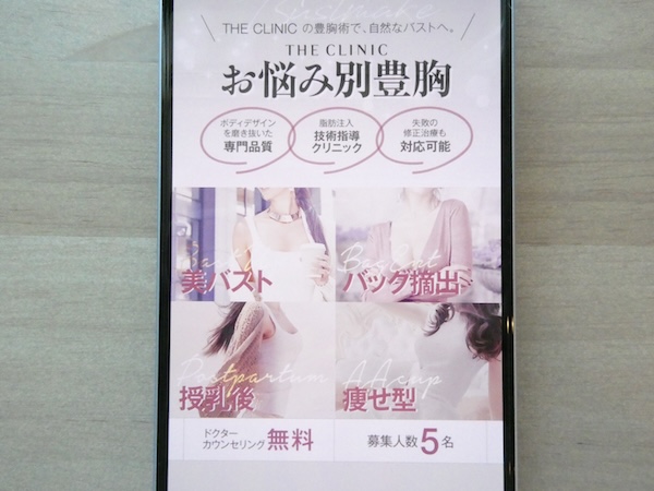 THE CLINIC(ザクリニック)は自然な仕上がりを考慮した技術が魅力【東京おすすめ2】