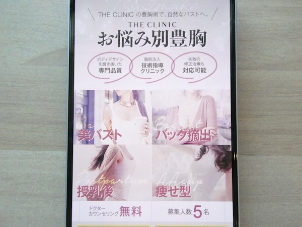 THE CLINIC（ザクリニック）は自然な仕上がりを考慮した技術が魅力【心斎橋おすすめ2】