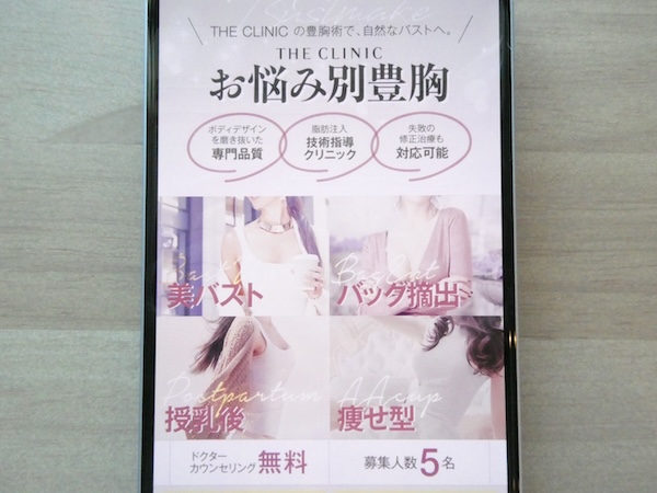 THE CLINIC(ザクリニック)は自然な仕上がりを考慮した技術が魅力【梅田おすすめ2】