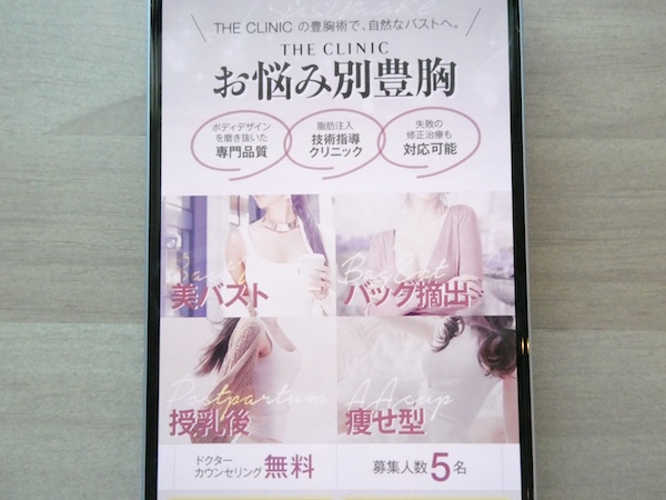 THE CLINIC(ザクリニック)は自然な仕上がりを考慮した技術が魅力【広島おすすめ2】