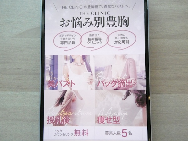 THE CLINIC（ザクリニック）は自然な仕上がりを考慮した技術が魅力【名古屋おすすめ2】