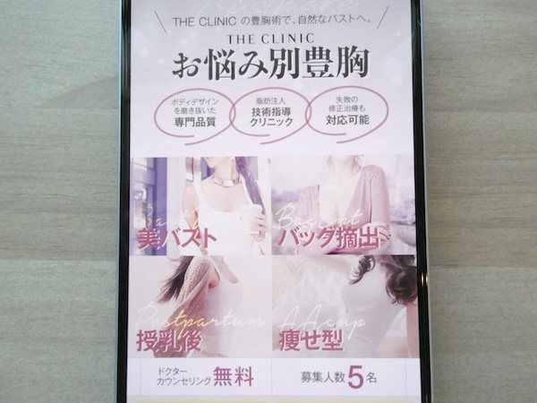THE CLINIC（ザクリニック）は自然な仕上がりを考慮した技術が魅力【福岡おすすめ2】