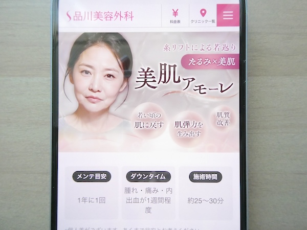 品川美容外科は糸リフトプランが豊富に揃っている【上野おすすめ3】