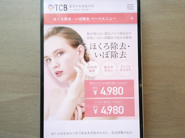 TCB東京中央美容外科は電気メスが手頃で相談しやすい【上野おすすめ1】