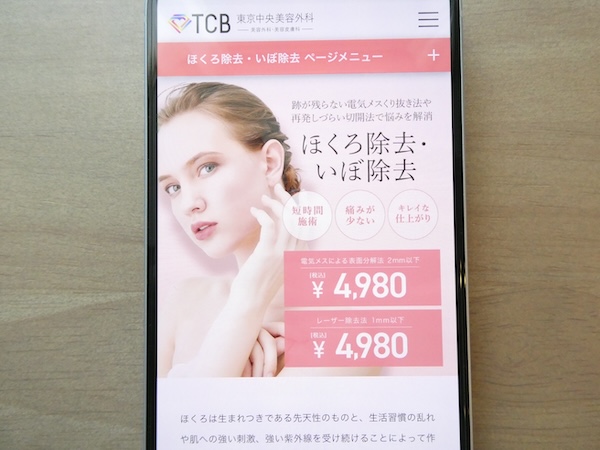 TCB東京中央美容外科は電気メスが手頃で相談しやすい【札幌（北海道）おすすめ1】