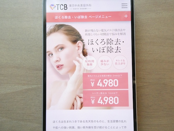 TCB東京中央美容外科は電気メスが手頃で相談しやすい【大阪おすすめ1】