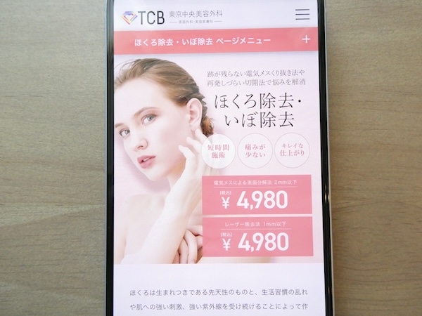 TCB東京中央美容外科は電気メスが手頃で相談しやすい【心斎橋おすすめ1】