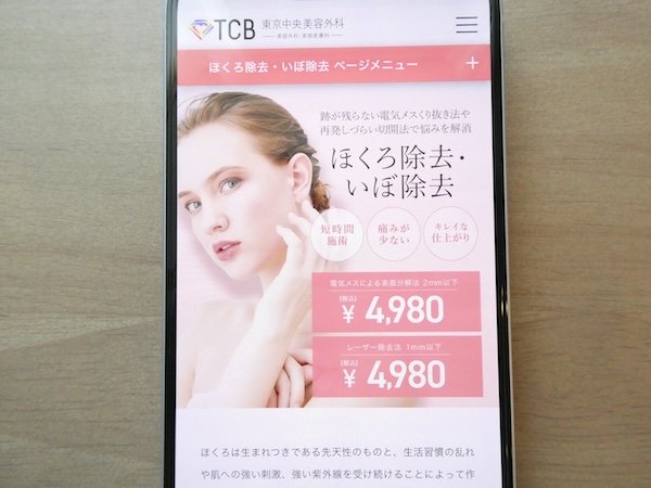 TCB東京中央美容外科は電気メスが手頃で相談しやすい【京都おすすめ1】