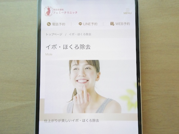 フェミークリニックは切除法の2mm未満なら1か所3,300円で手頃【池袋おすすめ4】