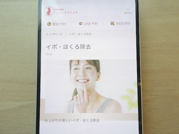 フェミークリニックは切除法の2mm未満なら1か所3,300円で手頃【大阪おすすめ6】