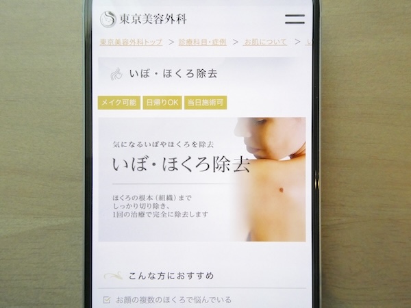東京美容外科はアブレーション施術で1mmごとに5,500円【大阪おすすめ3】