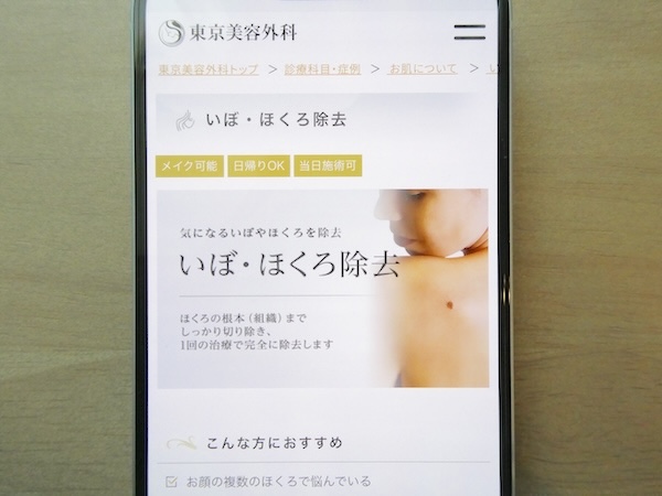 東京美容外科はアブレーション施術で1mmごとに5,500円【梅田おすすめ3】