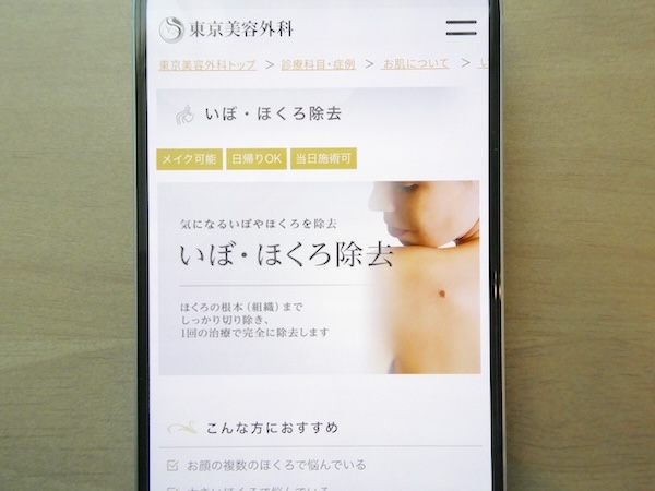 東京美容外科はアブレーション施術で1mmごとに5,500円【池袋おすすめ2】