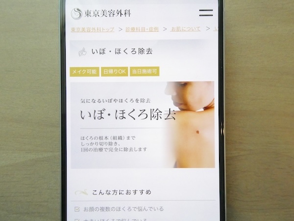 東京美容外科はアブレーション施術で1mmごとに5,500円【横浜(神奈川)おすすめ3】