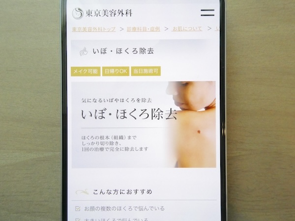 東京美容外科はアブレーション施術で1mmごとに5,500円【名古屋おすすめ3】